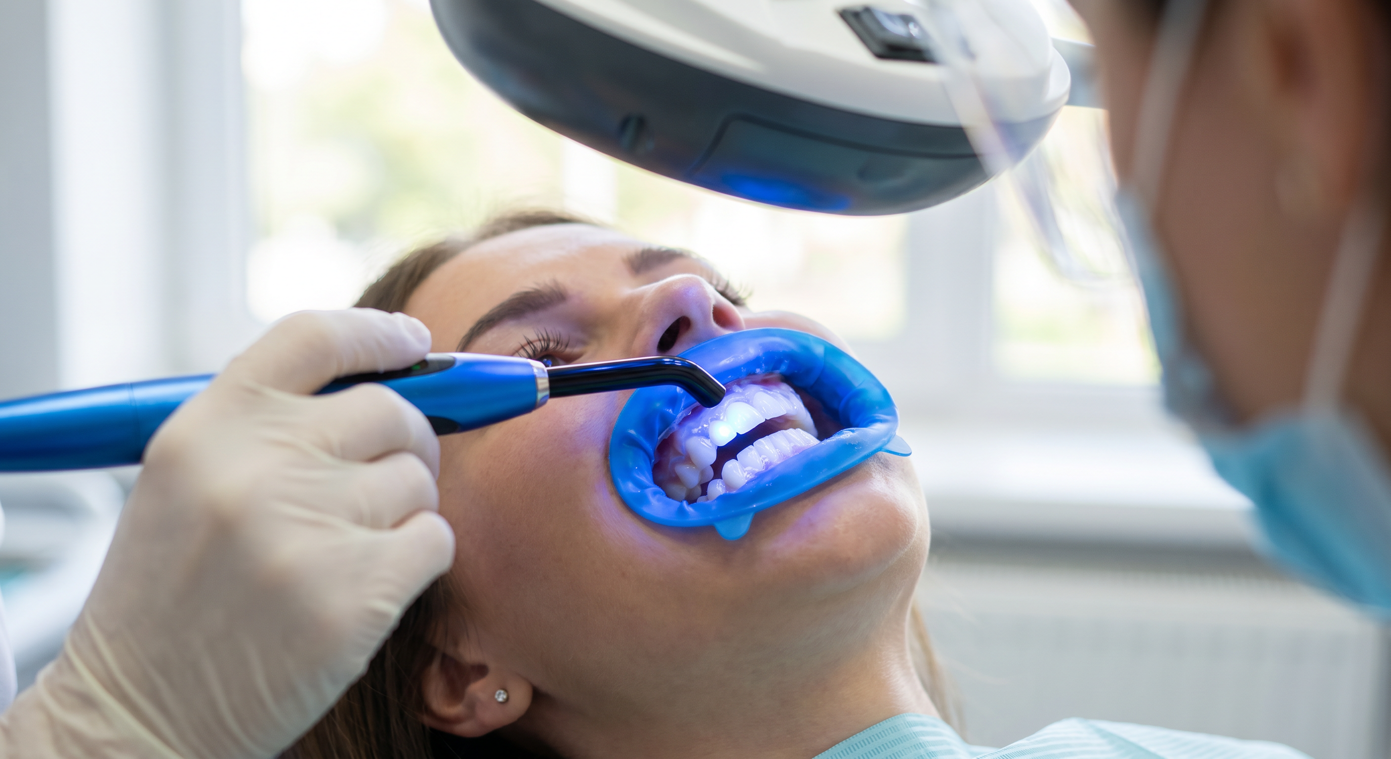Cosmetic Dentistry at Warrington Dental Centre