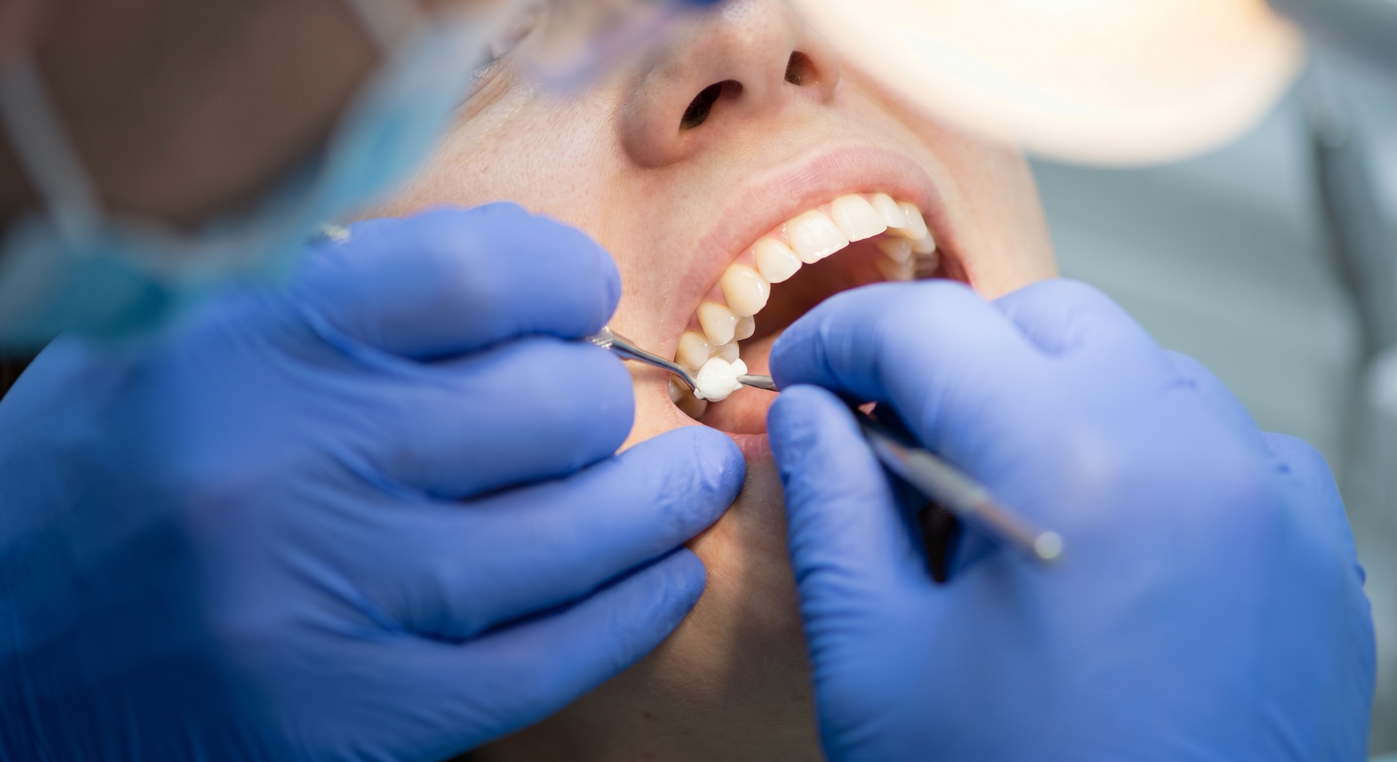 Emergency Care at Warrington Dental Centre
